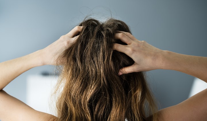 Woman with itchy scalp Woman with itchy scalp