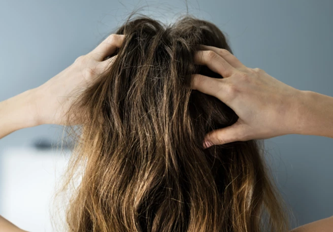 How to deal with dry and flaky scalp?